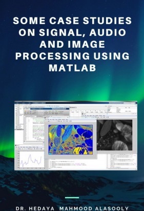Some Case Studies on Signal Audio and Image Processing Using Matlab